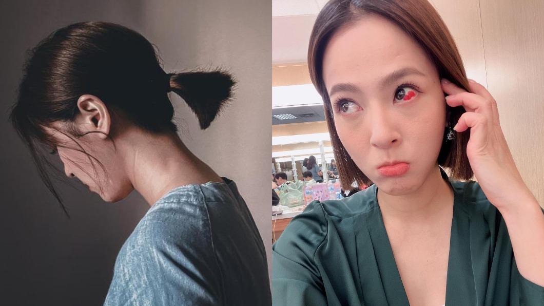 醒來又熱又刺!本土劇女星突冒「大片血塊」就醫...破裂了