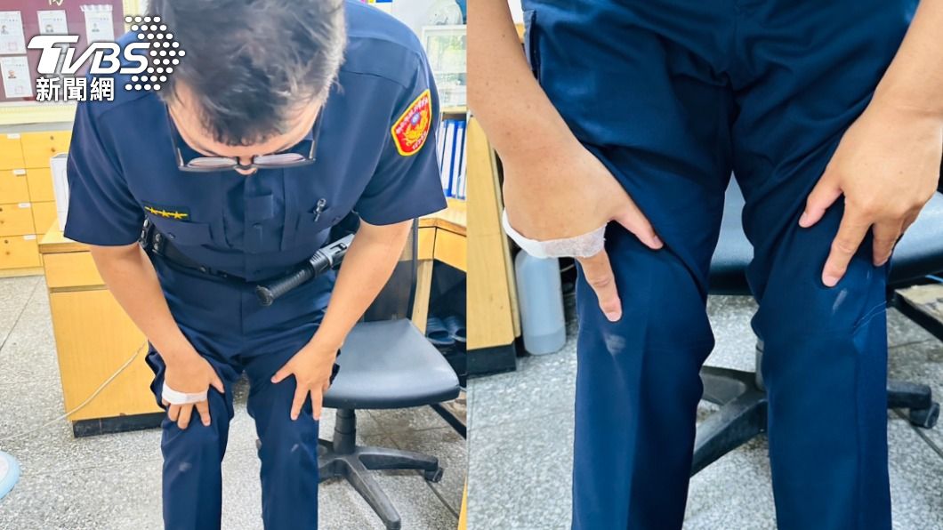 員警手掌、膝蓋擦挫傷。(圖/TVBS)