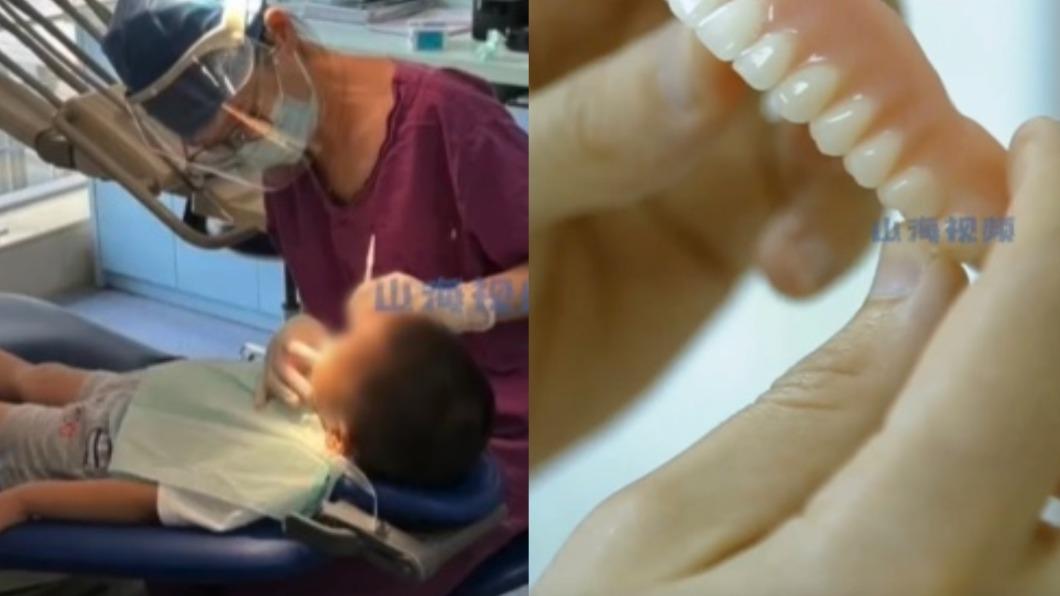 14歲就當阿公!他張嘴醫秒嚇壞 揭1習慣「牙齒全爛光」
