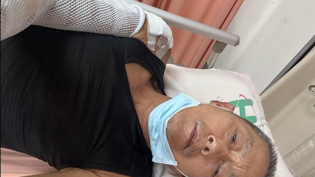 67歲國寶男星驚出車禍!險失明「右半身脫落見肉」恢復現況曝