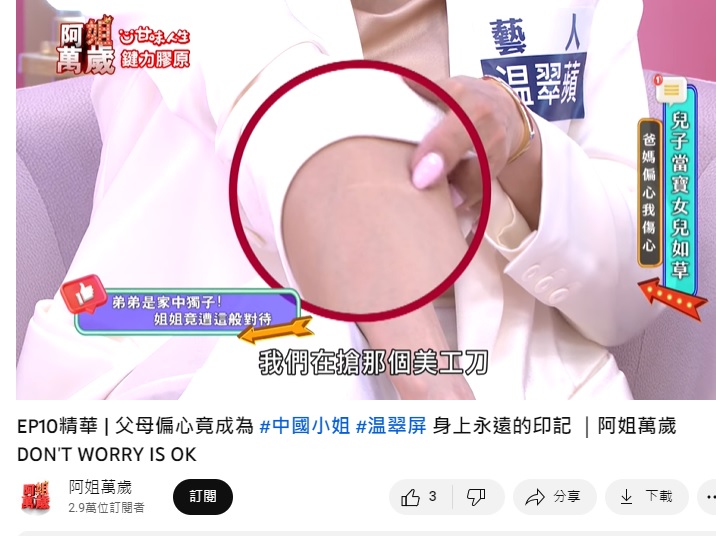 溫翠蘋曾被弟弟拿刀劃一刀，當場血流如注。（圖／翻攝自阿姐萬歲YT）