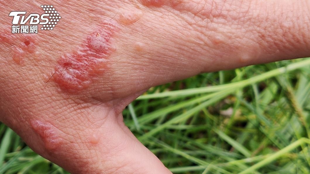 大豕草被稱為「英國最危險植物」。（示意圖／Shutterstock達志影像）