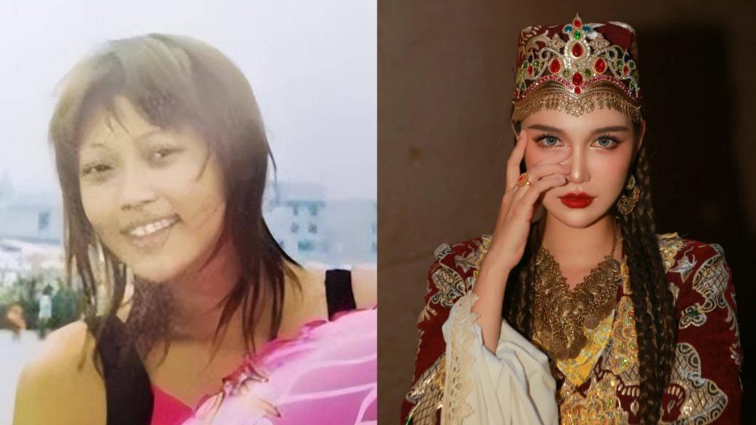 14歲就整形！網美動刀300次「走路突吐血」　驚人對比瘋傳
