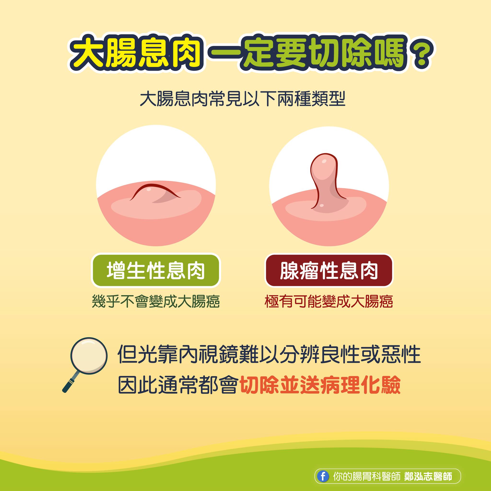 腺瘤性息肉極有可能發展成大腸癌。(圖/翻攝自鄭泓志醫師粉專)
