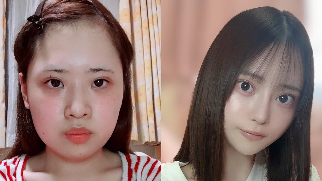 日本正妹砸百萬曬「整形前後對比圖」 網讚:好像乃木坂