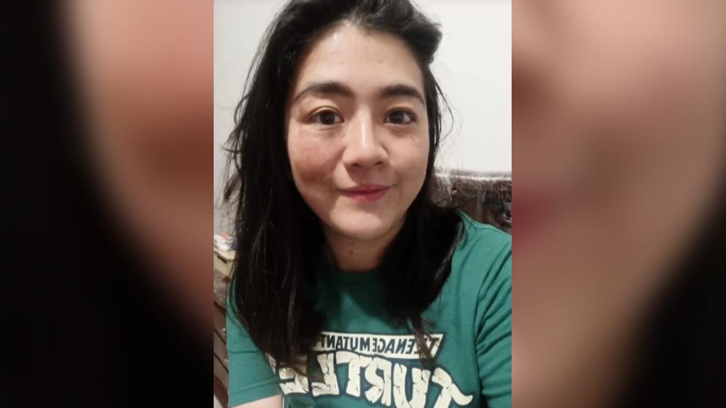 恩迪亞臉部皮膚復原的情況非常良好。(圖/翻攝自TikTok@kathe_life)