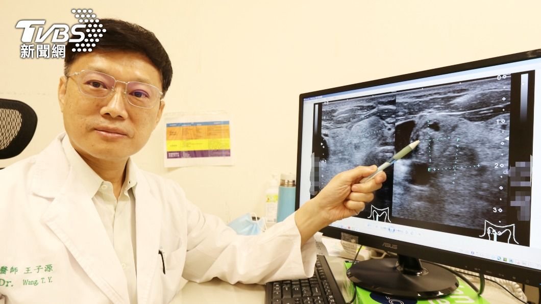 醫師提醒民眾若有爆瘦、脖子腫等狀況，要當心甲狀腺亢進問題。（圖／亞大附醫提供）