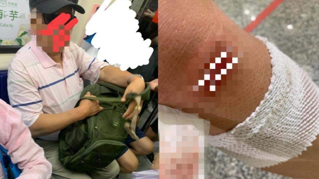 腳摔傷坐博愛座！墨鏡伯踢鞋「英文逼讓位」　她心寒：之前都會讓