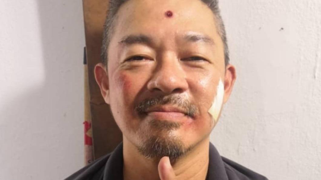 張詠華驟逝「享年51歲」!曾認「想輕生」 2惡疾纏身:我病了