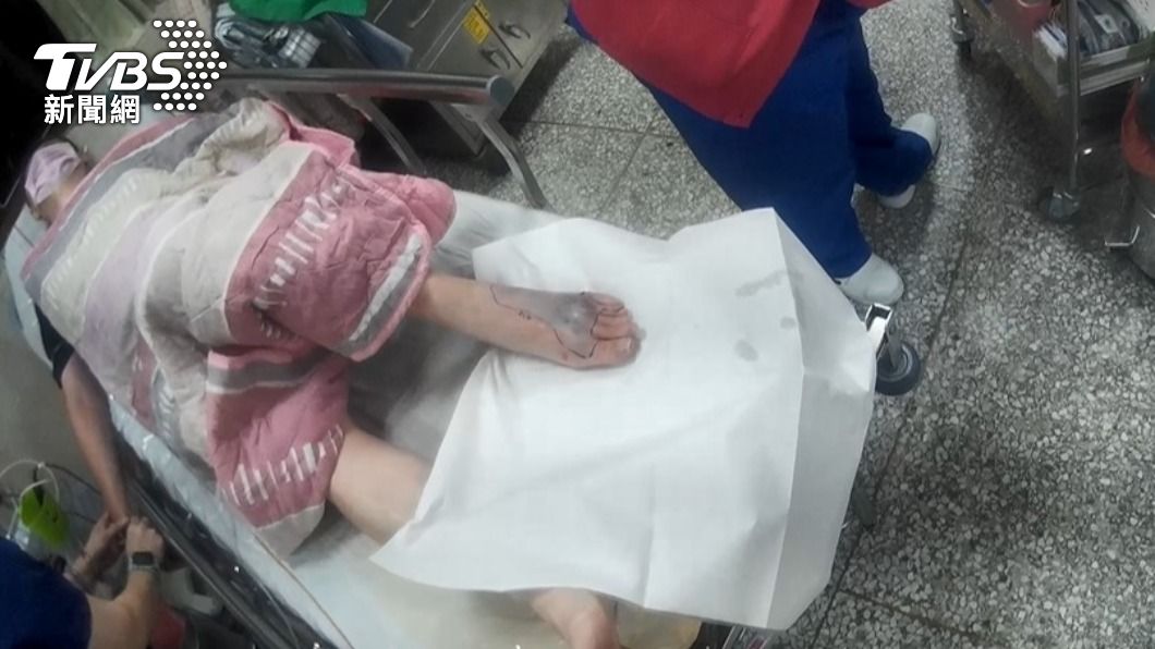 男子花蓮泡湯遭龜殼花蛇吻 左腳背「腫脹發黑」驚悚畫面曝
