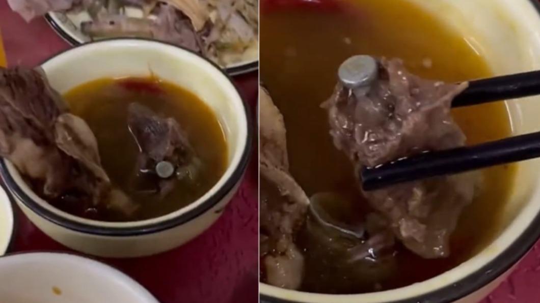 喝湯吃到骨釘!網疑「人肉湯」一看嚇翻:骨科手術專用
