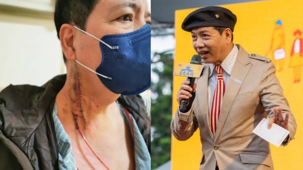 好心疼!男星罹癌又痛失老母 現身悲訴遺憾「用生命主持」