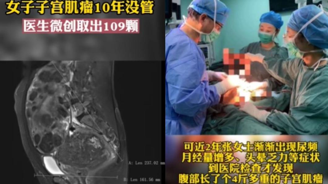 張女長子宮肌瘤10年沒管。(圖/翻攝自微博《陝視新聞》)