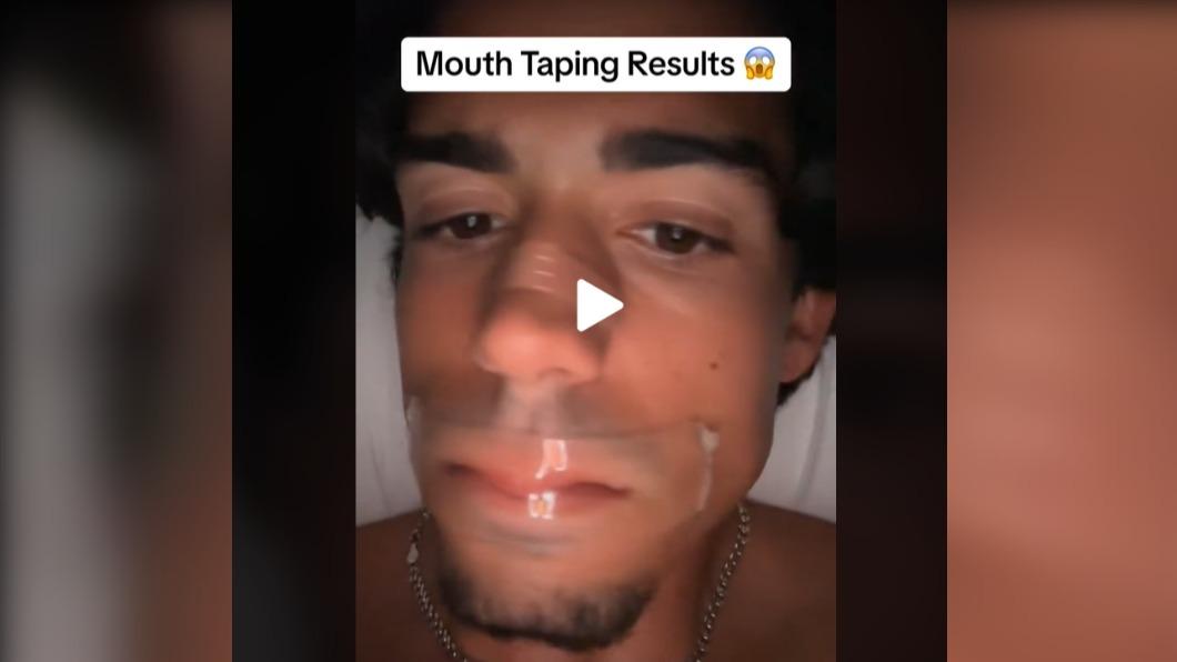 雖然不少專家同意，TikTok的膠帶封嘴睡覺行為是一種療法，但也提醒民眾不要隨便嘗試。（圖／翻攝自TikTok）