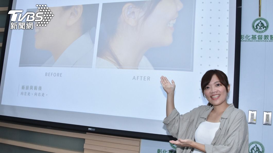 正妹設計師追求燦爛笑容 彰基正顎手術圓夢