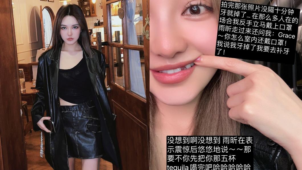 周揚青看演唱會出事!「吃掉一顆牙」嚇壞 缺牙照瘋傳笑了:沒齒難忘