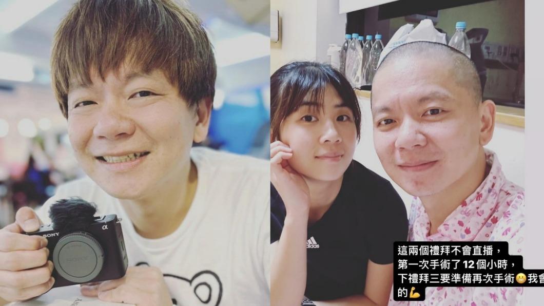 80萬網紅腦瘤破裂開腦!動刀12小時「沒清乾淨」 理光頭憔悴露面