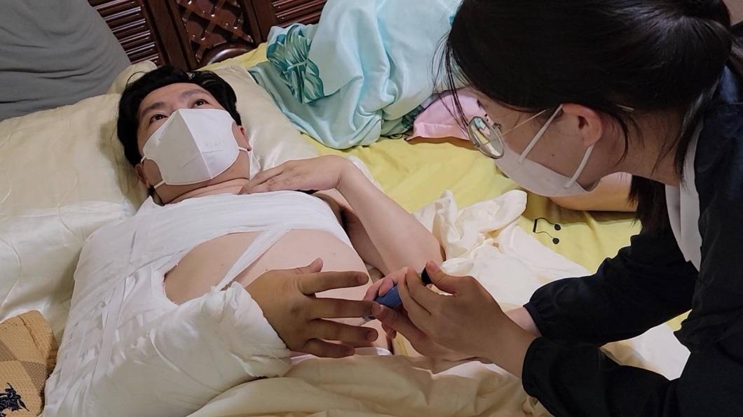 好心疼！58歲男星小兒麻痺又粉碎性骨折　爆腹部「全是針孔」