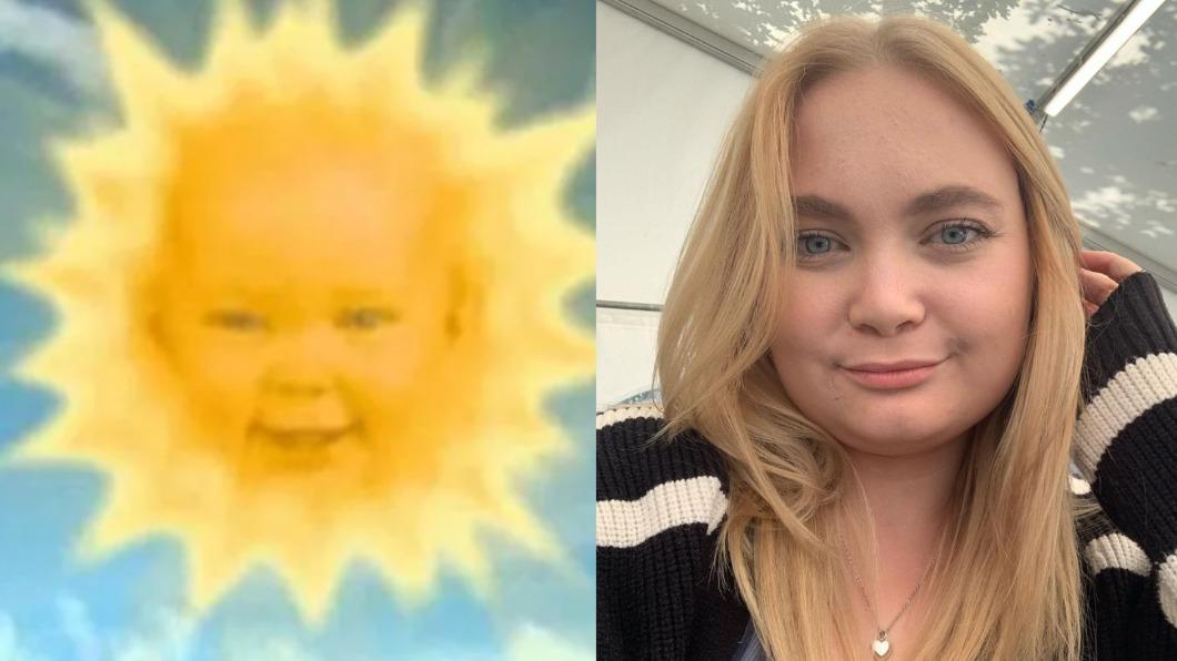 天線寶寶「太陽嬰兒」當媽了!27歲現況曝光 喜曬超音波照甜爆