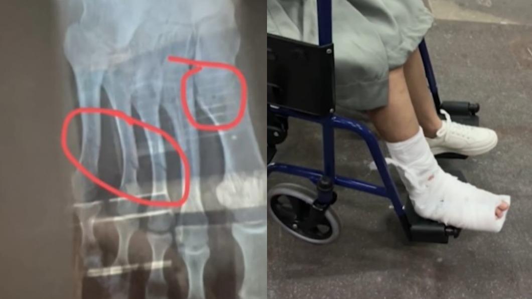 女子4根腳趾骨折。 (圖/翻攝自微博《沸點視頻》)