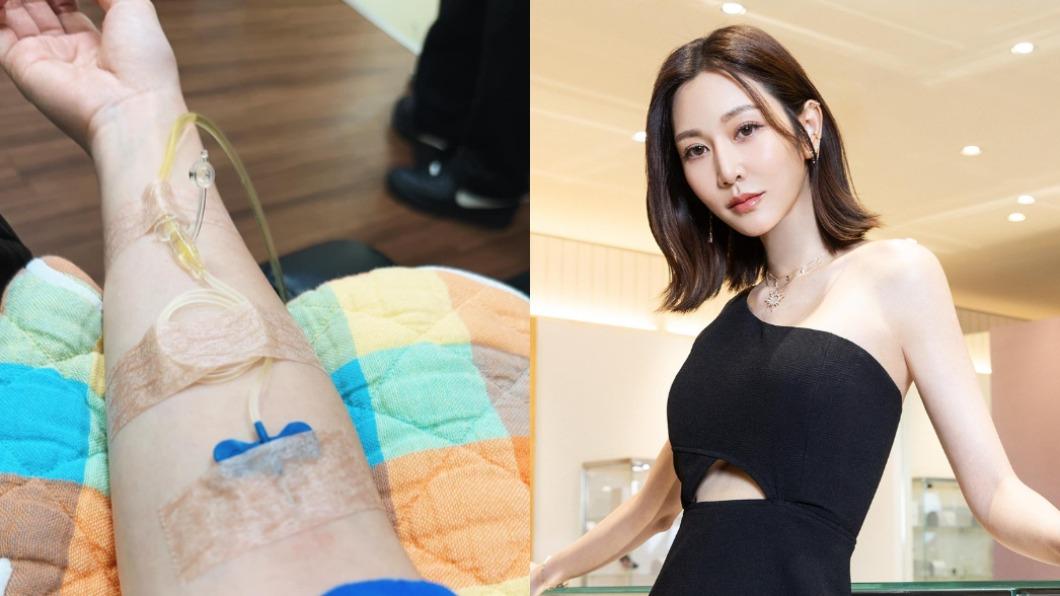 出事了!台劇女神病倒送醫吊點滴 高燒多天「原因不明」