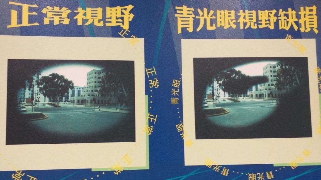 少年使用類固醇藥水止癢1年，出現視覺模糊。（圖／院方提供）