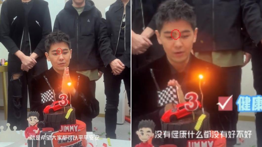 林志穎眉頭有道紅色傷疤,引發外界擔憂。(圖/翻攝自林志穎微博)