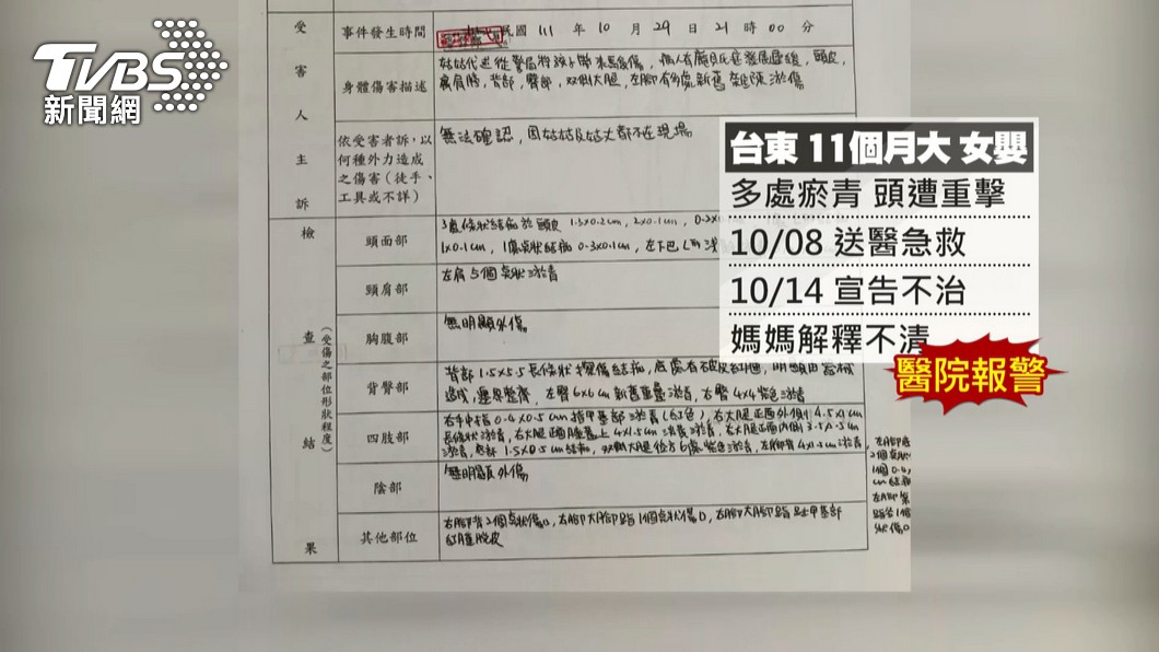 圖／TVBS