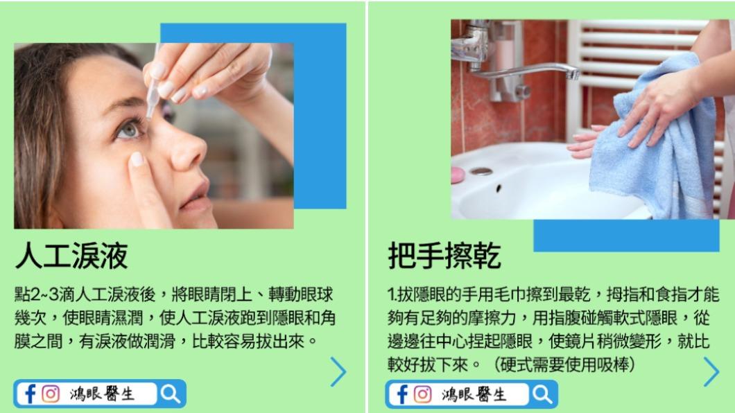 醫師分享拔隱眼2妙招。（圖／翻攝自鴻眼醫生｜林宜鴻眼科醫師臉書）