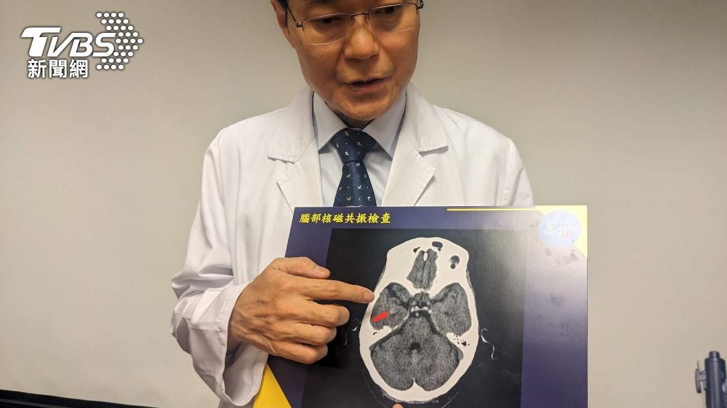 男遊埃及以為看到前世記憶 頻現「既視感」竟是癲癇發作