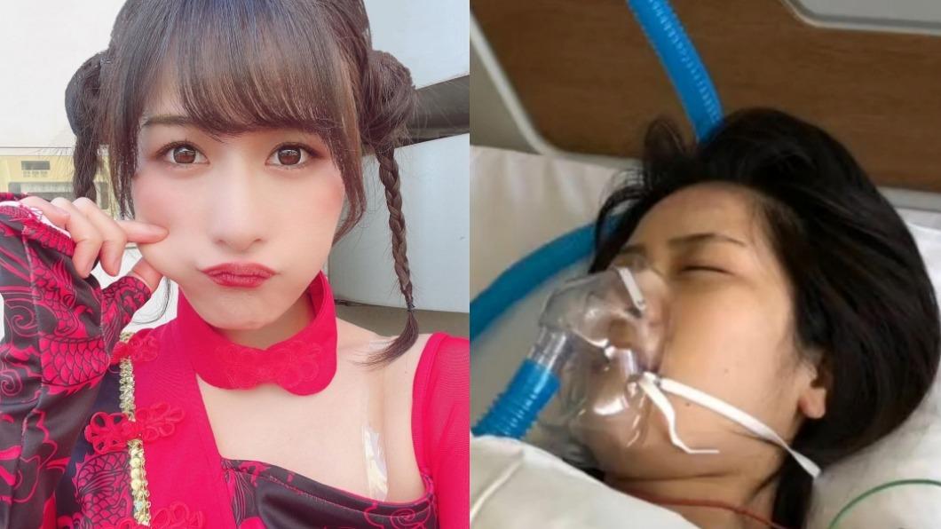 女星衰遭百公斤木牌砸中！　悲吐半身癱瘓致排泄障礙：沒尿意了