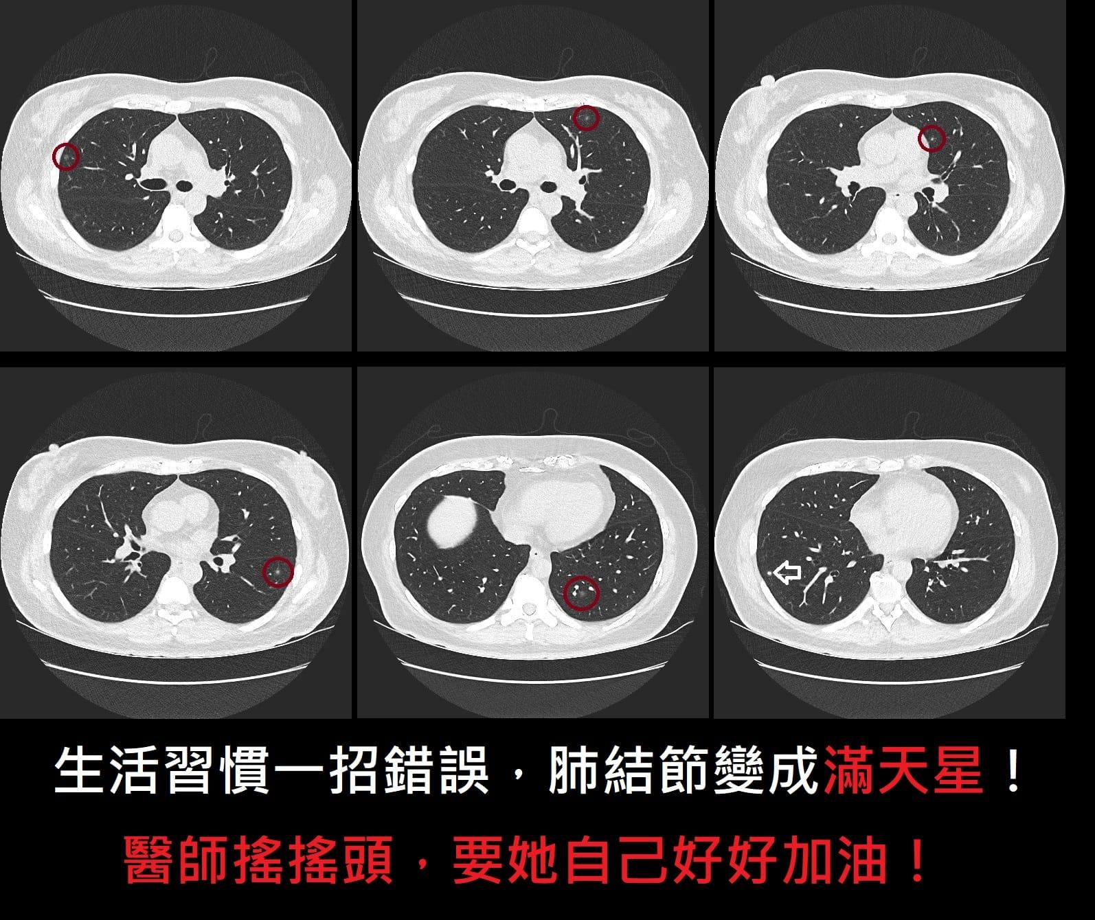 蘇一峰分享病例。(圖/翻攝自蘇一峰臉書)