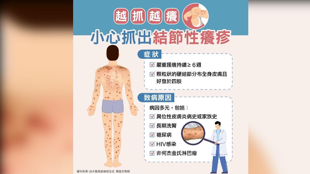 結節性癢疹資訊。(圖/醫師提供)
