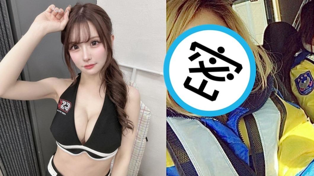 網紅妹砸400萬整型!厚唇滿嘴暴牙 「驚人對比照」起底