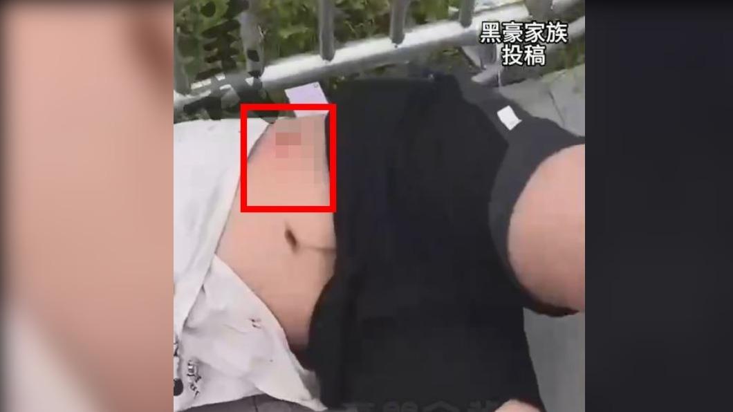 賴男被砍的傷處。(圖/翻攝黑豪家族)