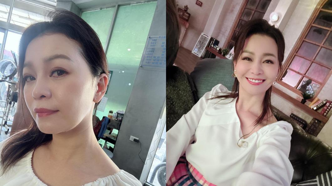 謝宜君感謝大家關心,傷口正在慢慢癒合。(圖/翻攝自謝宜君臉書)