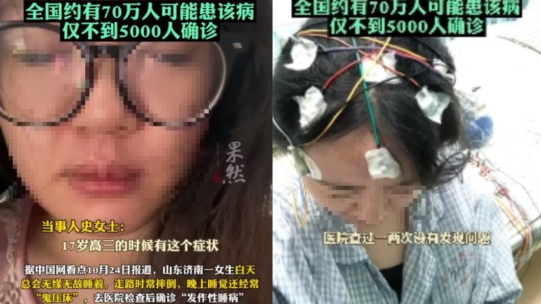 該名女子走路會突睡著或跌倒嗜睡。（圖／翻攝自微博@齊魯晚報）