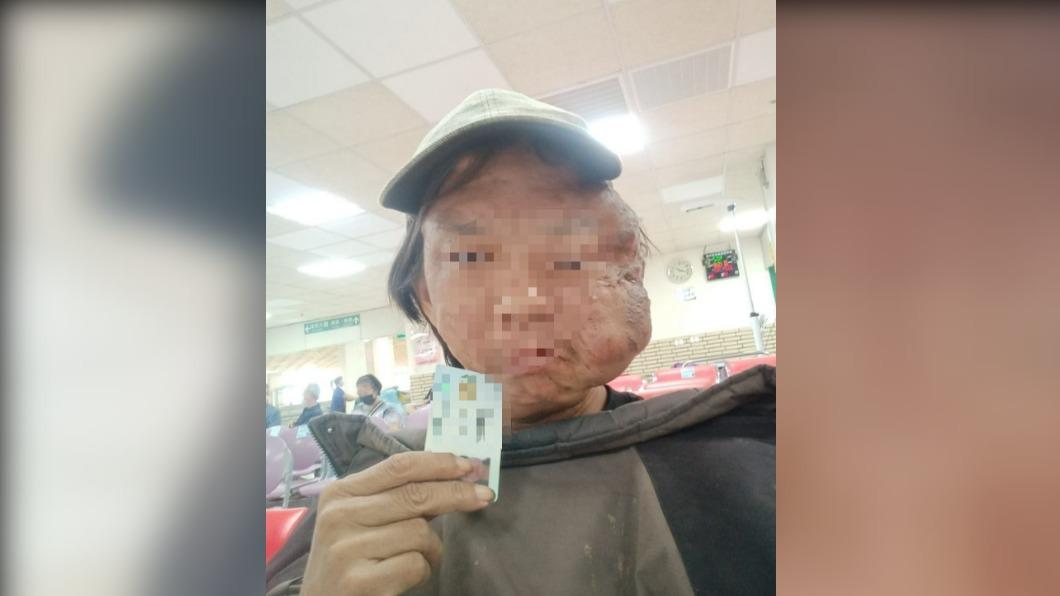 男子正在積極的治療看診,但醫藥費相當可觀。(圖/翻攝自嘉義新鮮事臉書)
