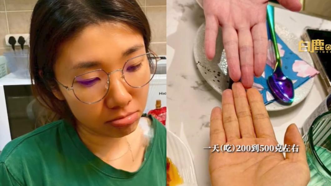 減肥狂嗑1蔬果!妹子3個月後照鏡子 「慘變小橘人」染色了