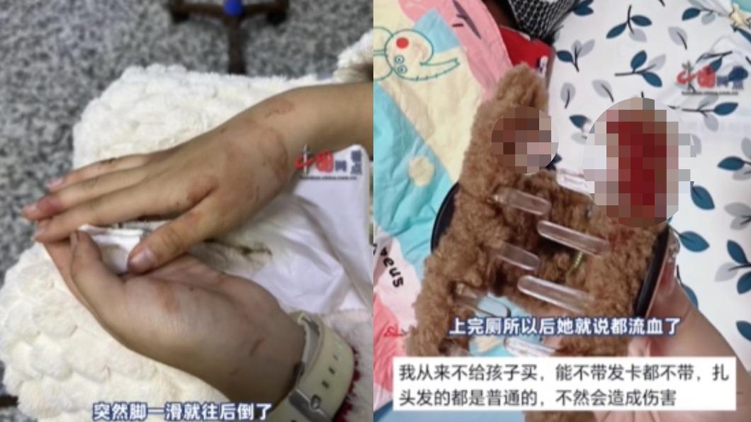 鯊魚夾沾滿鮮血。(圖/翻攝自微博《梨子影片》)