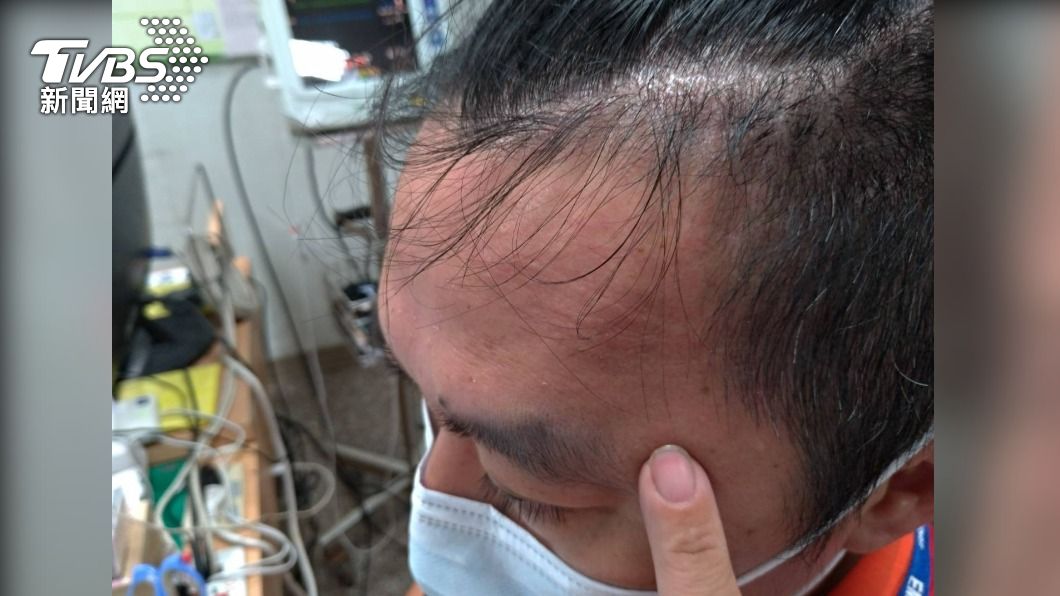 徐姓航空救護員左邊太陽穴血腫、輕微腦震盪。(圖/TVBS)