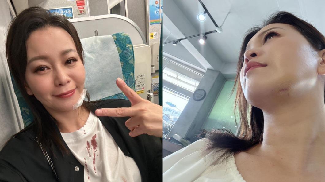 陳隨意才被爆離婚淨身出戶 愛妻濺血縫6針驚喊「魂魄飛走了」