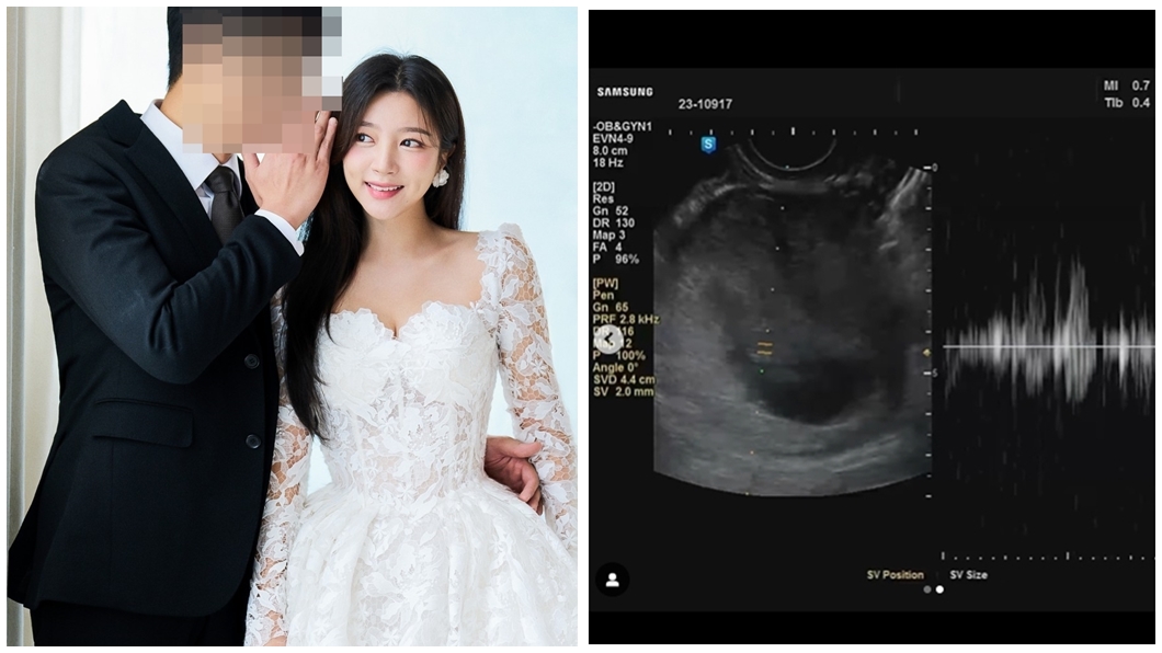 女星無預警宣布懷孕閃婚!「新郎身分」曝 絕美婚紗閃炸