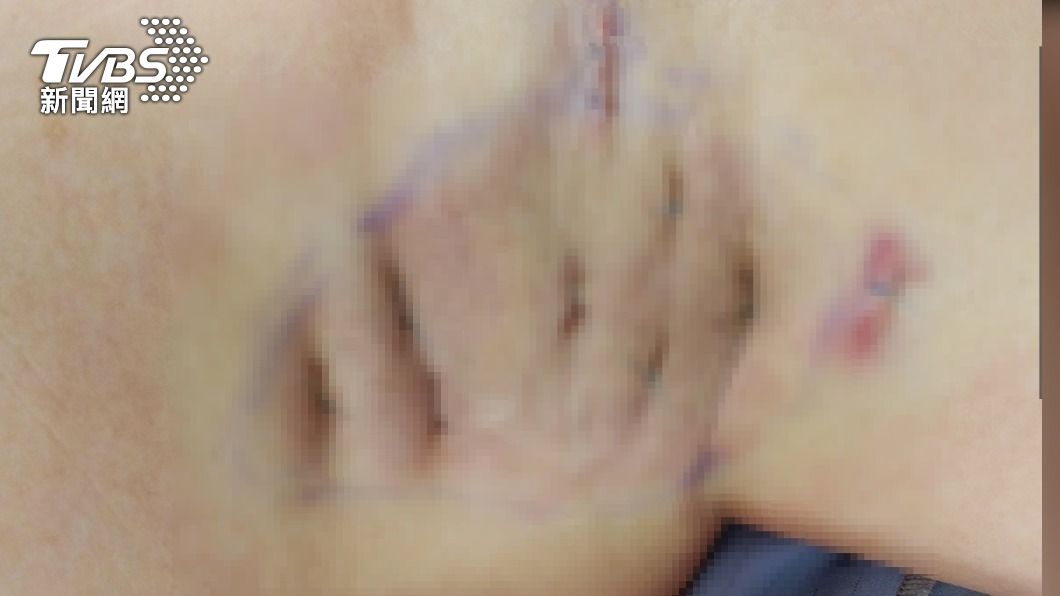 頂漿腺又稱大汗腺 如果分泌旺盛恐形成難聞氣味