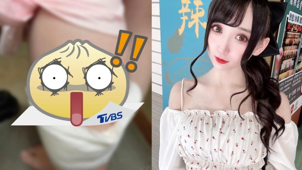 日本女偶像來台遭流浪狗攻擊! 驚曝見血照「好怕全身肉被挖咬」