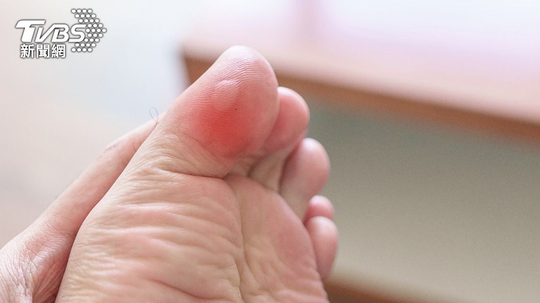 腳長水泡引爆失明!潰爛吞噬整條腿 她慘骨折「全截掉保命」