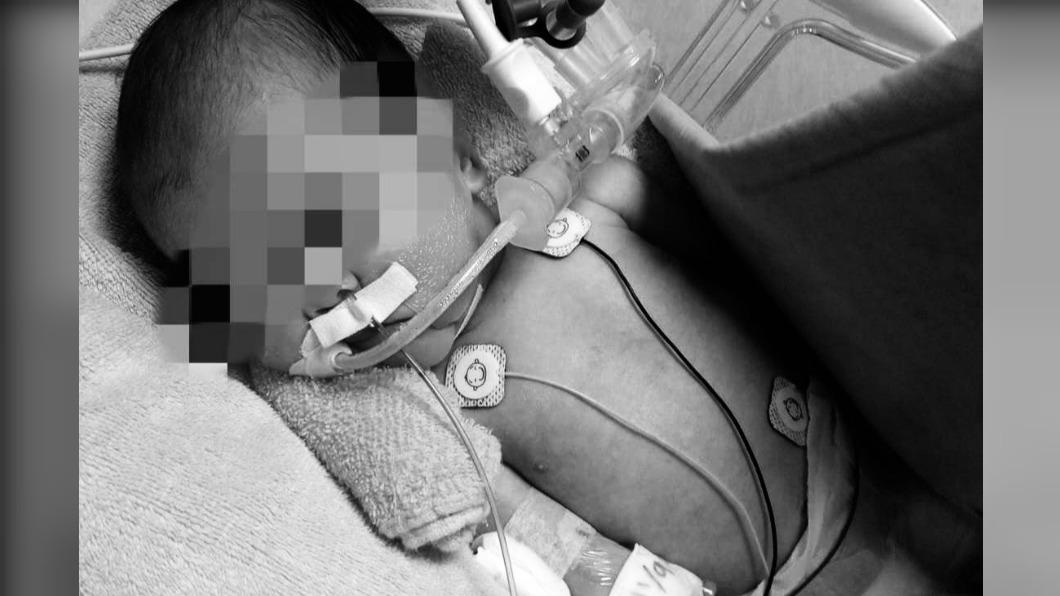 高雄婦幼醫院爆疏失 女嬰出生僅18天全身插管仍不治
