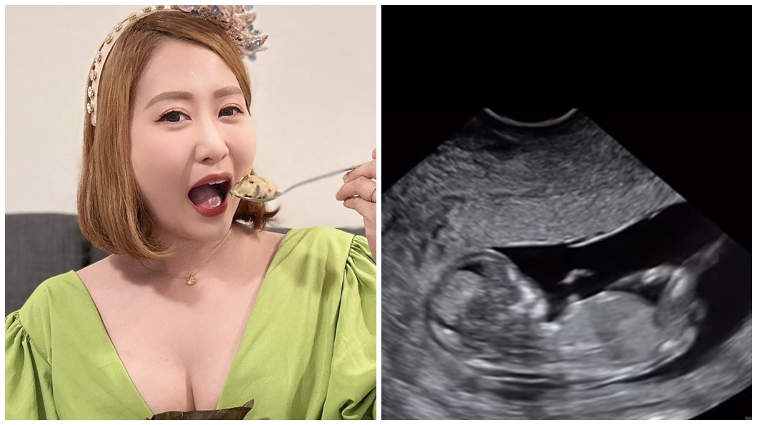 曾被判不孕!女星無預警宣布懷孕 喜曬超音波照:我的寶貝