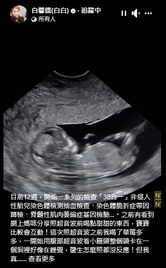 女星白白曬出超音波。（圖／翻攝自白馨儒臉書）