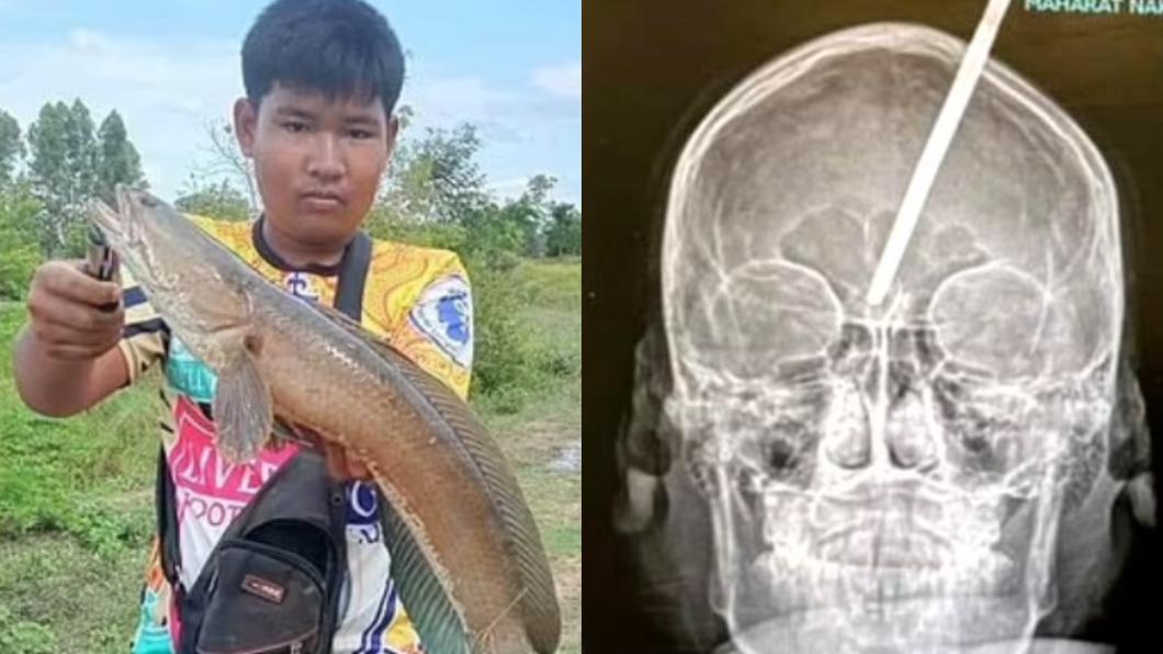 泰男發射30公分魚叉捕魚 碰石頭反彈半截「插入自己腦門」